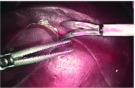 Towards entry "Clearer images for medicine"