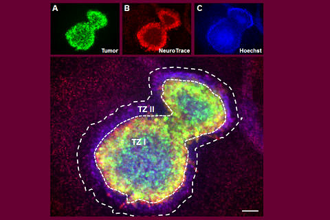 Towards entry "New model for vascular and tumour research"