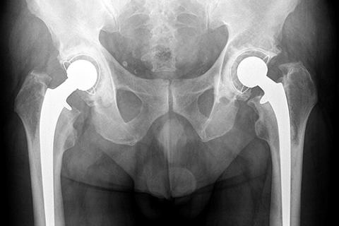 Towards entry "3D X-ray dark-field reconstruction"