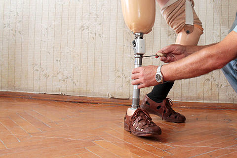 Towards entry "Printable prosthetics"