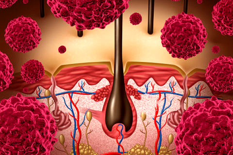 Towards entry "Tracking cancer’s signalling pathways"