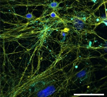 Towards entry "Confusion at the neuronal level"