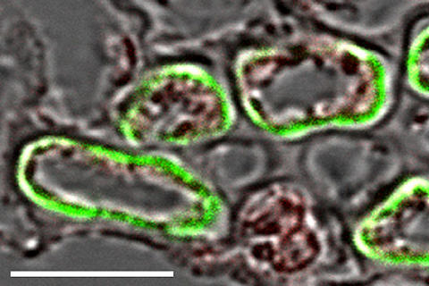 Towards entry "From the cell into the veins"