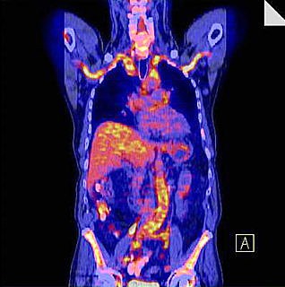 Towards entry "Faster apprehension of fever causes"