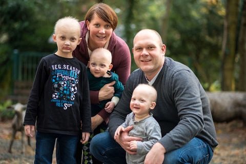 Towards entry "Very first successful attempts at therapy for genetic disorder ectodermal dysplasia"