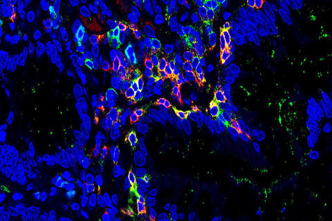Towards entry "Cells that destroy the intestine"