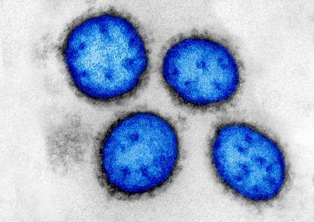 Towards entry "Tracking down silent killers"