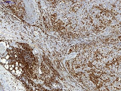 Towards entry "White blood cells indicate the extent to which treatment is successful"