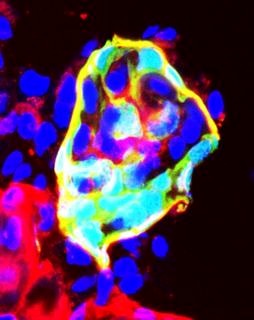 Towards entry "New research project focuses on rare kidney disease"