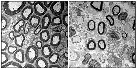 Towards entry "Defective sheath"