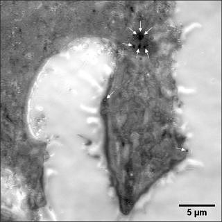 Towards entry "‘Coronascope’ enables live observations of COVID-19 infections"