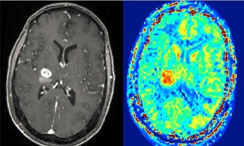 Towards entry "Detecting signs of disease even earlier with MRI"