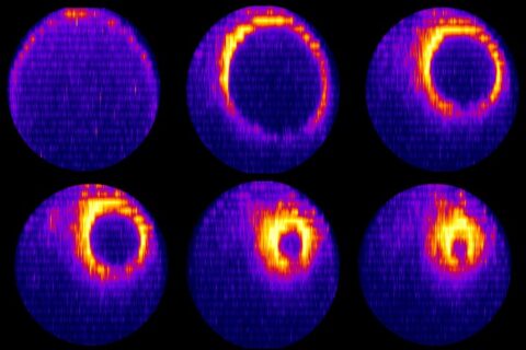 Towards entry "Cell research: One becomes two in 20 minutes"